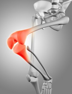 “Prosperous Life, Healthy Campus” Series of (Online) Seminars - Gout and arthritis "豐盛人生、健康校園” 系列(網上)專題講座 - 痛風與關節炎